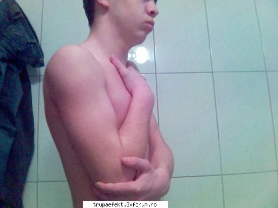 mi-am clavicula tocmai timpul vacantei vara ... stat mana ghipsz cateva saptamani